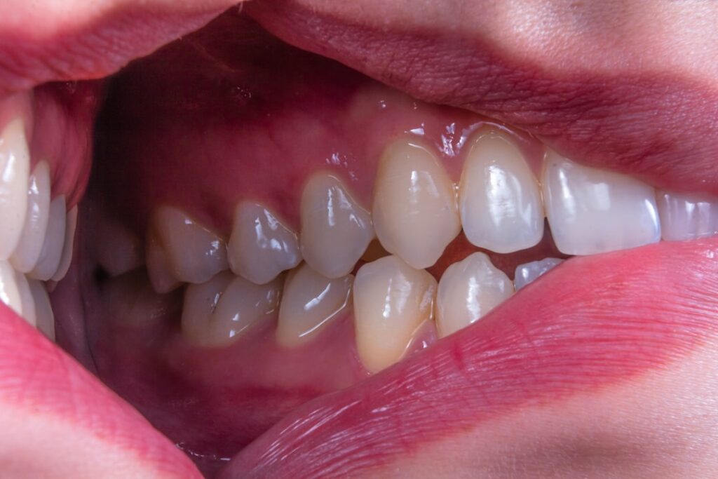 Photo Vocal cords